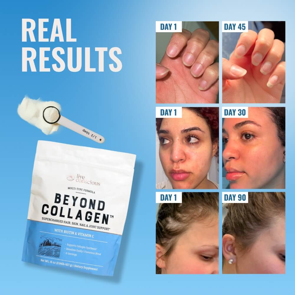 Beyond Collagen®